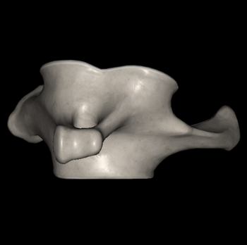 日野脊椎回復運動