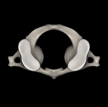 日野脊椎回復運動